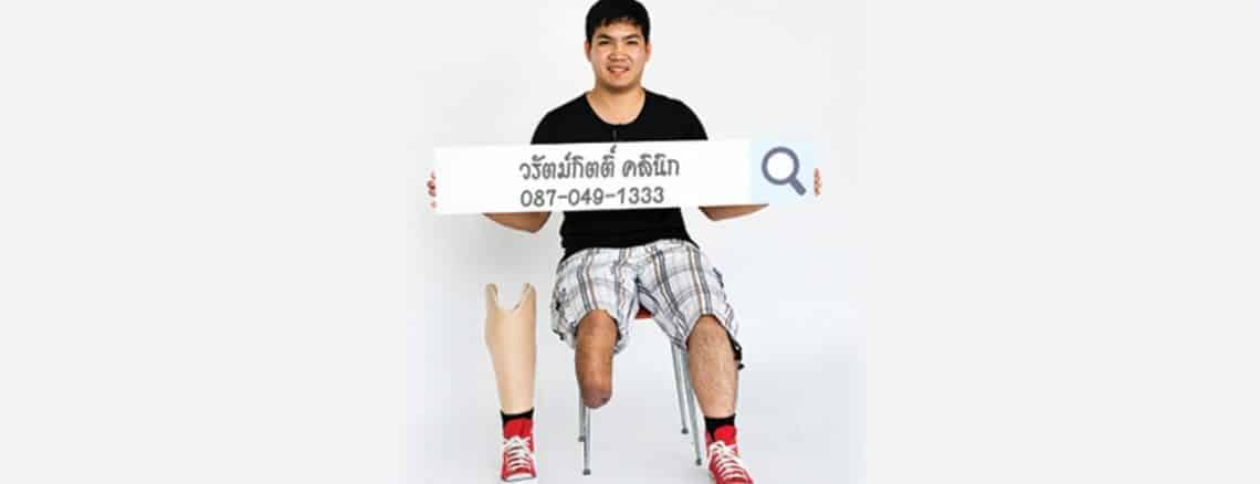 วรัตม์กิตติ์ คลินิก ขาเทียม โดย นักกายอุปกรณ์ 4 ขาเทียม