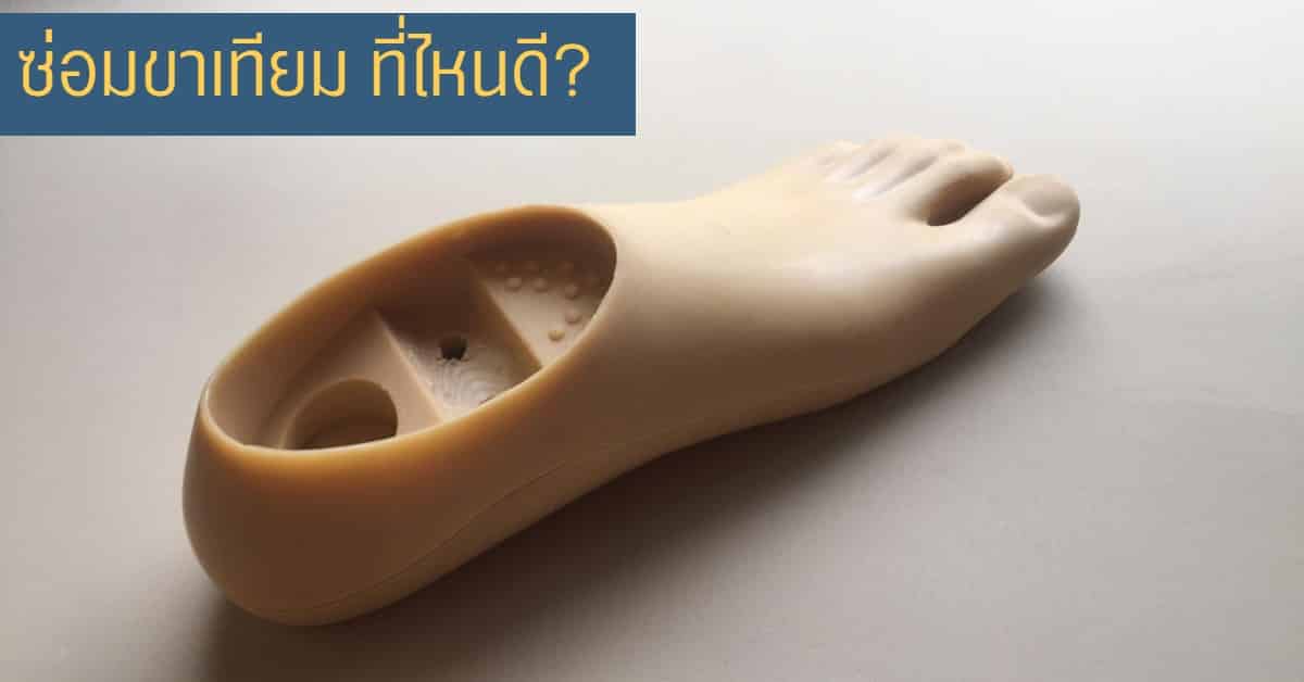 ซ่อมขาเทียม