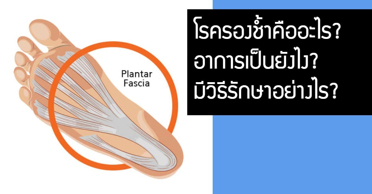 โรค รองช้ำ คือ อะไร