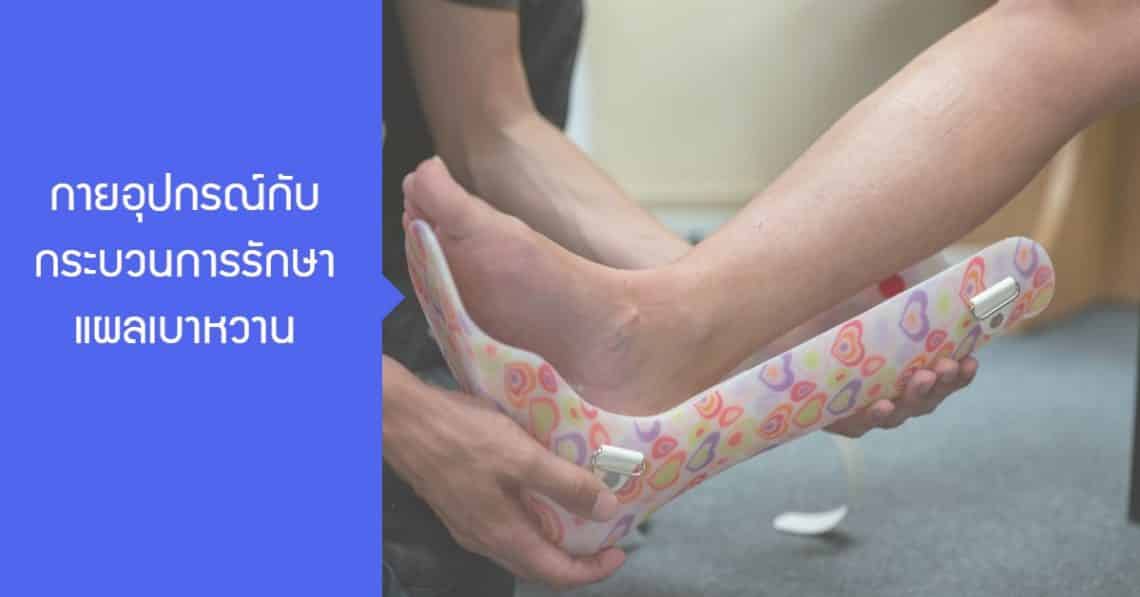 กายอุปกรณ์กับกระบวนการรักษาแผลเบาหวาน 4 รักษาแผลเบาหวาน