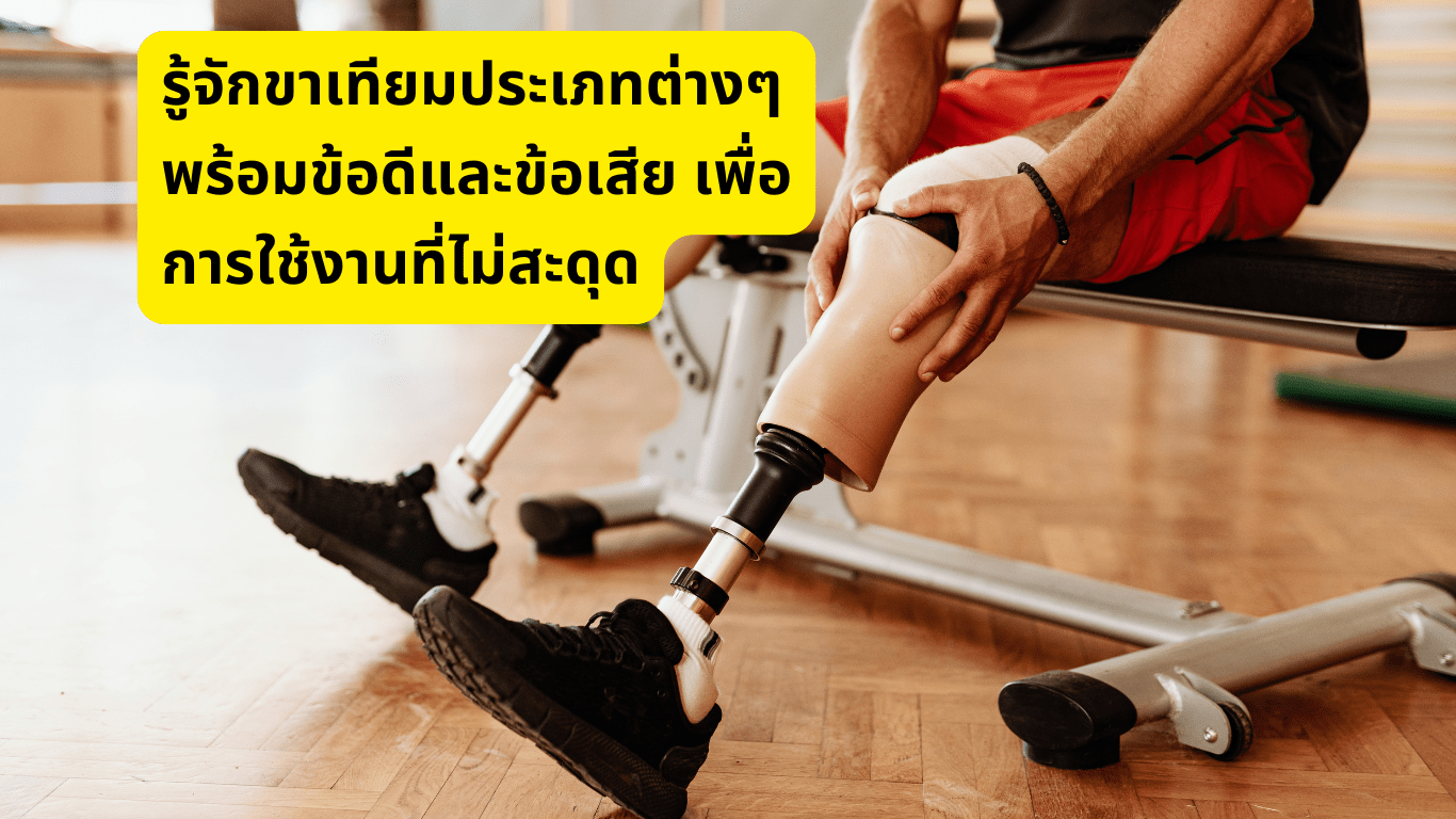 ขาเทียมประเภทต่าง