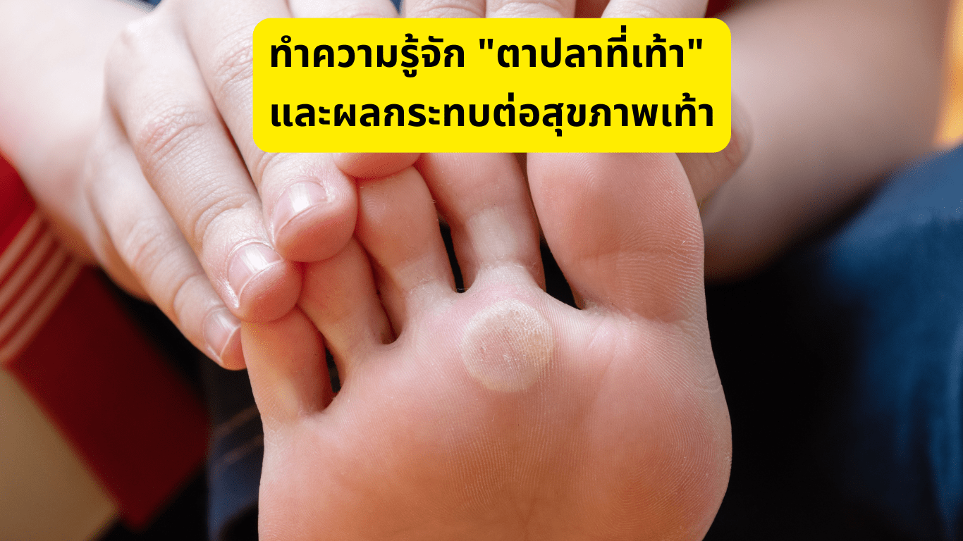 ตาปลาที่เท้า