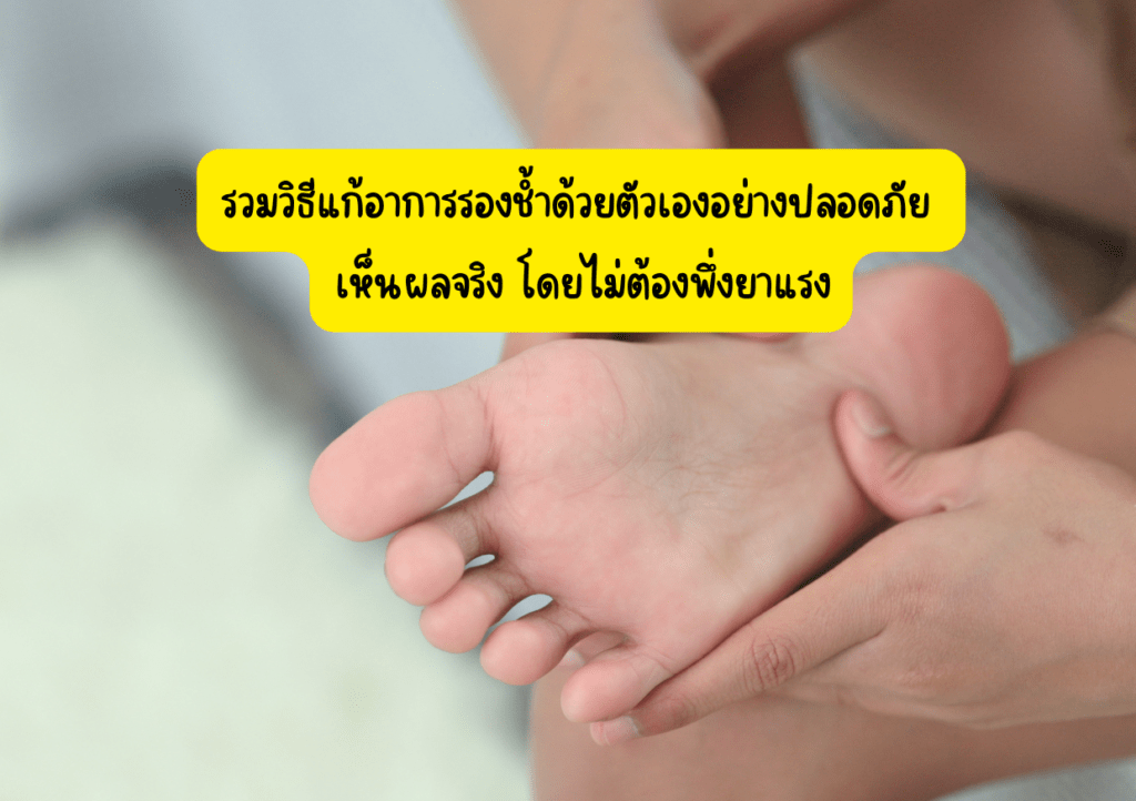 รวมวิธีแก้อาการรองช้ำด้วยตัวเองอย่างปลอดภัย เห็นผลจริง โดยไม่ต้องพึ่งยาแรง