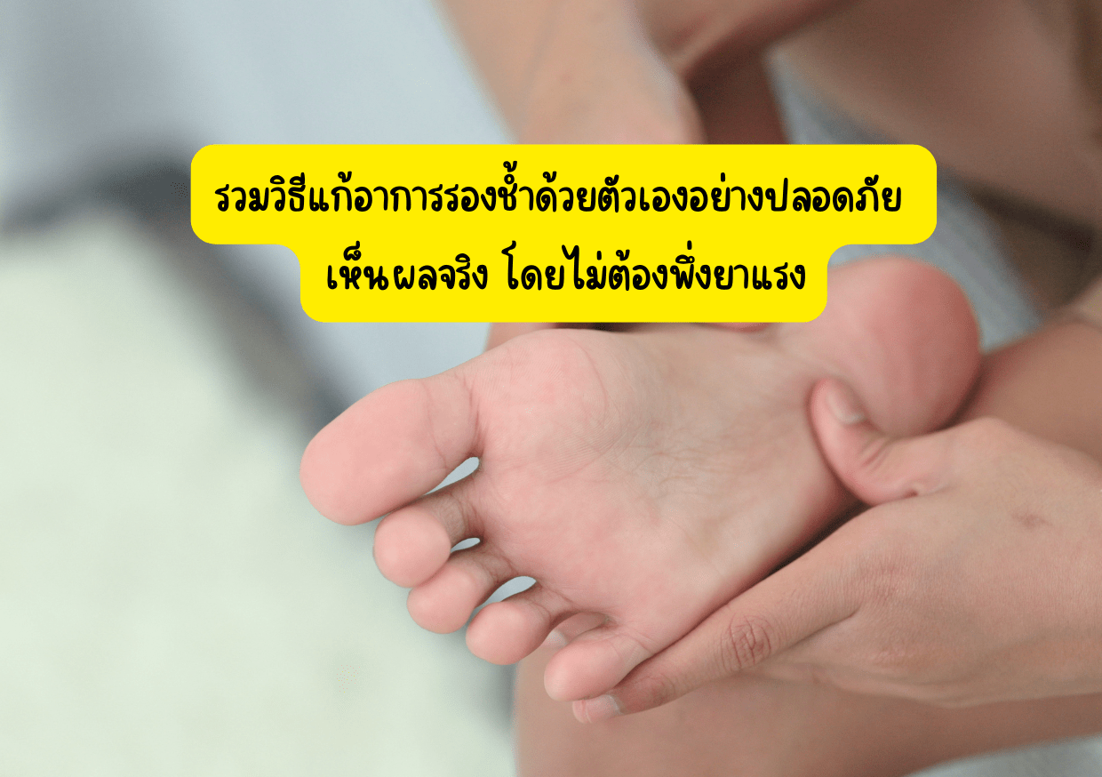 รวมวิธีแก้อาการรองช้ำด้วยตัวเองอย่างปลอดภัย เห็นผลจริง โดยไม่ต้องพึ่งยาแรง